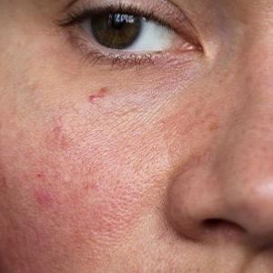 Routine beauté Peau sensible