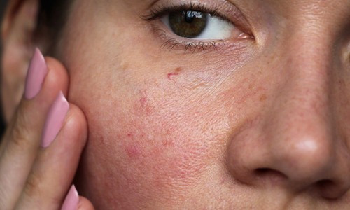 Routine beauté Peau sensible